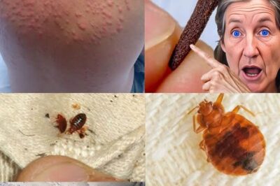 Bedbugs: Simple Methods to Eradicate Them from Your Home