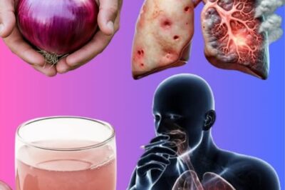 Persistent Cough, Mucus Buildup, or Lung Congestion? Try This Powerful Natural Onion Remedy